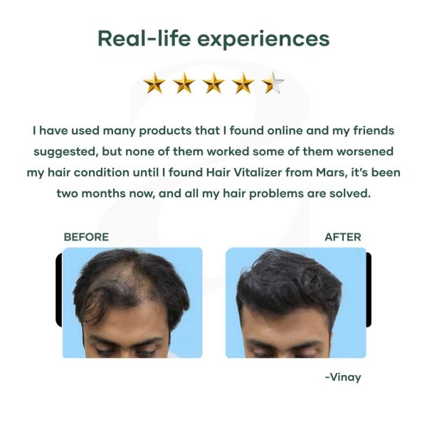 Hair Vitalizer with 1% Redensyl For Cheap