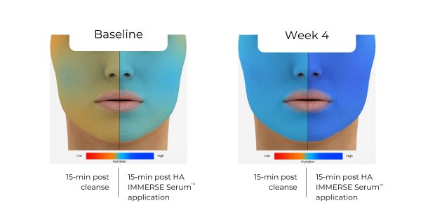 HA (Hyaluronic Acid) IMMERSE Serum™ Online Hot Sale